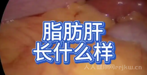 为什么长期喝酒会患上脂肪肝的原因